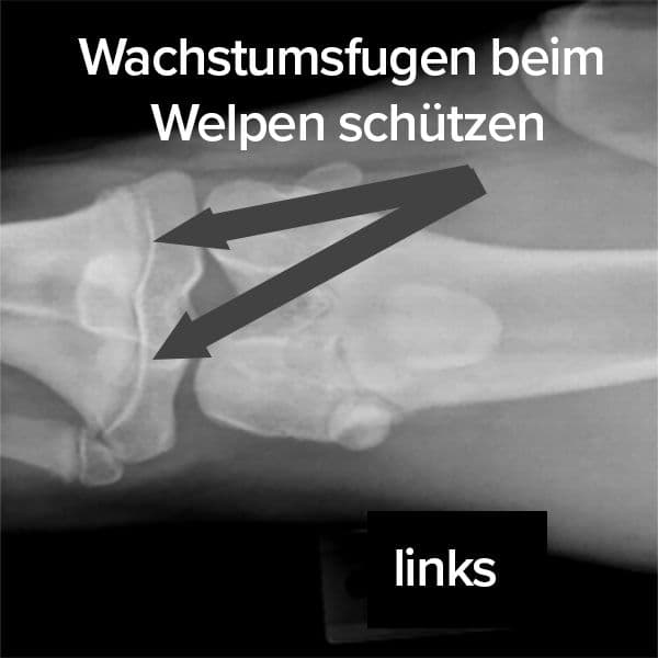 Was sind Wachstumsfugen?